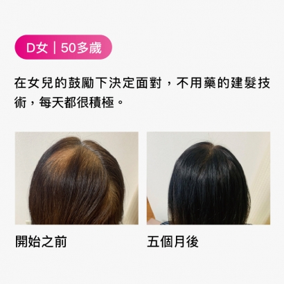 D女｜50多歲